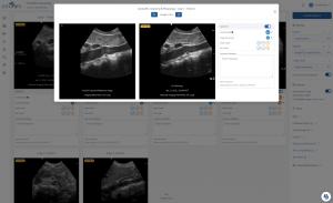 SonoSim Launches Automated Ultrasound Image Assessment Powered By ...