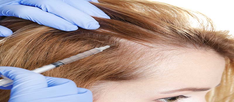 Alopecia Treatment Market Demand, Share, Growth, Trend Analysis, Global ...