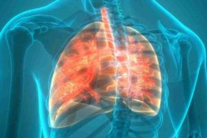 Cystic Fibrosis Market