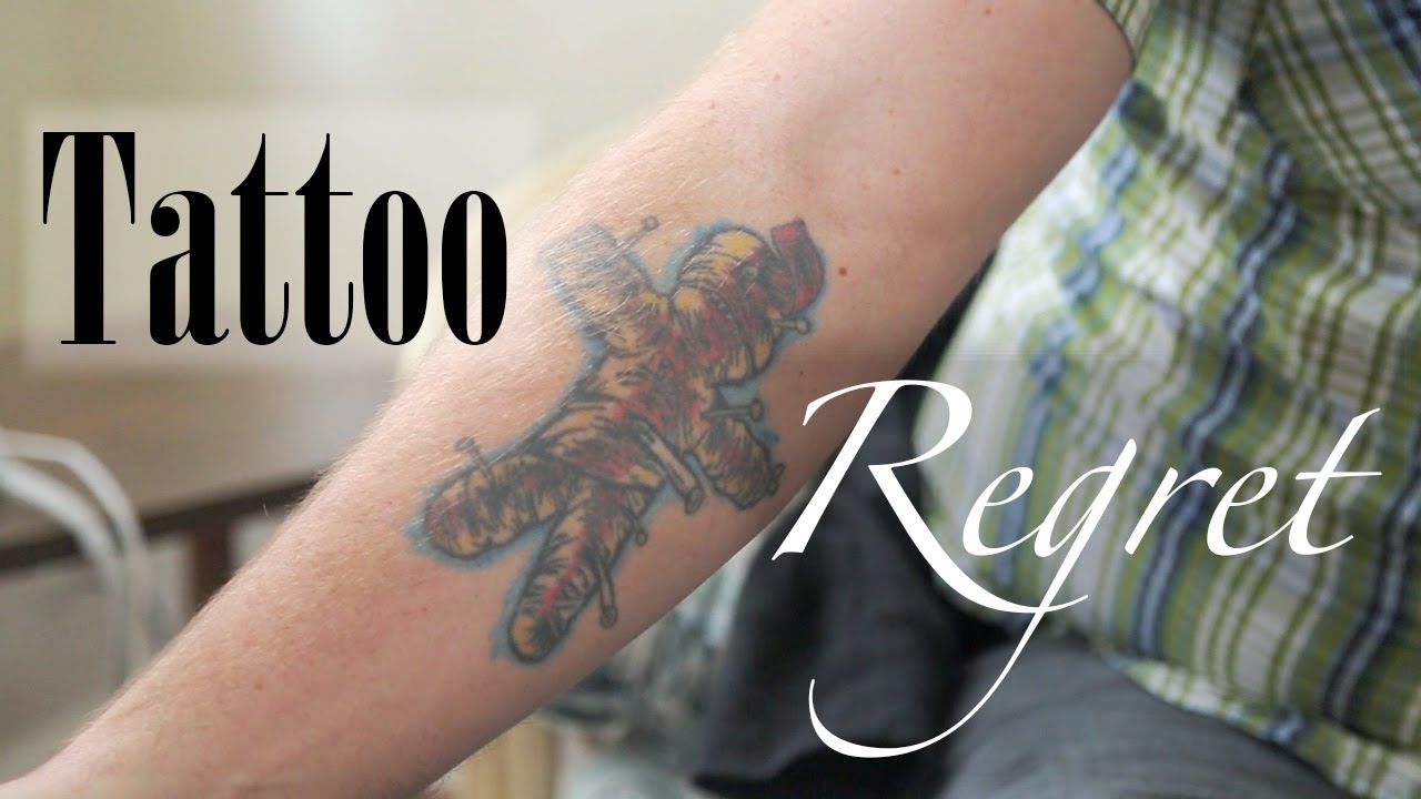 The 5 Places For The Best Tattoo Removal in Fresno California   Bestinfresnocom