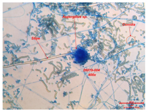 Carpet Dust sample under a microscope