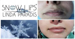 Snow lipss