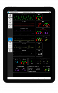 VitalStream application on a tablet