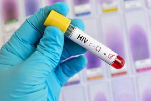 HIV Diagnostics Test Market Report