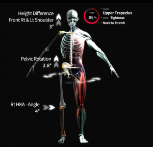 Image of the posture of a human with muscles and bones.