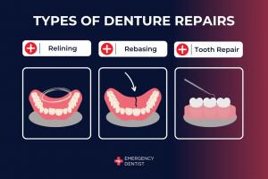 Denture Repairs Perth