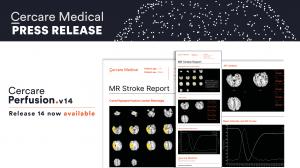 CMN Release14