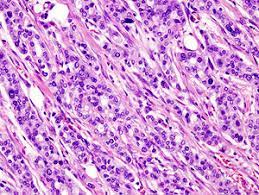 Market Overview:
The pancreatic ductal carcinoma market t is expected to exhibit a CAGR of 5