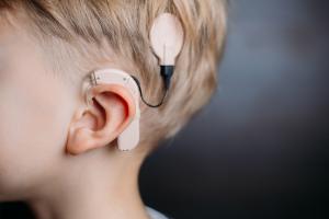 Cochlear Implants Market Size