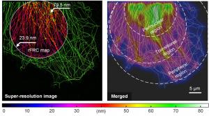 Figure 1 | Detecting the spatial resolution heterogeneity of super-resolution microscopy by using rFRC map.