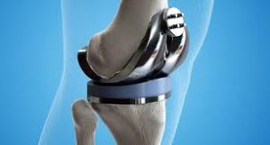 orthopedic devices market