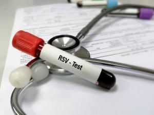 Respiratory Syncytial Virus Diagnostics Market 2024