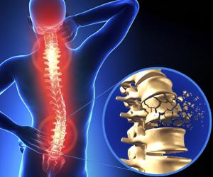 Spinal Cord Injury Therapeutics Market 2024