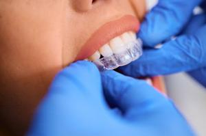 A close-up of a woman receiving a clear orthodontic aligner at a dentist's office.
