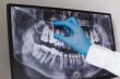 Understanding Dental Insurance Coverage: Preventative, Basic, and Major Services Explained