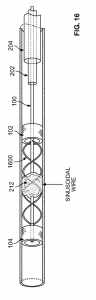 A medical device featuring a sinusoidal thrombus capture wire between two expandable spheres, used in vascular procedures for clot removal.