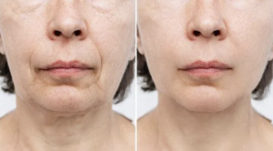 The Spa at Rescue MD before and after