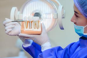 Dental Implants