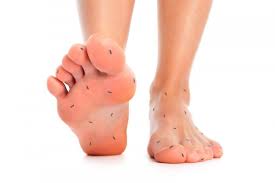 Global "Diabetic Neuropathy Market" Research Report is an in-depth study of the market analysis