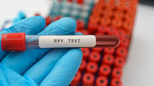 HPV Testing And Pap Test