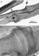 The Brookbush Institute Publishes NEW Course and Glossary Updates: 'Taut Band'
