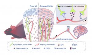 Fig 1. Schematic depicting the involvement of regional sympathetic nerves in the mediation of pain in early-stage TMJ-OA.