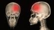 Primary Care Plays a Practical Role in Managing Migraine Treatment
