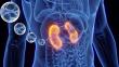 AION Healthspan Announces First Patient Treated in Phase I/II Clinical Trial for Cell Therapy in Chronic Kidney Disease