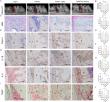 Unraveling the Mechanism Behind Orthodontic Tooth Movement