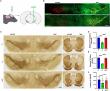 TFE3 Unlocks New Avenues for Parkinson’s Disease Treatment