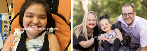 Rett Syndrome
