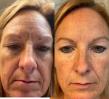 Sego Lily Skincare Brings Regeneratively Sourced, Tallow-Based Skincare to the Market