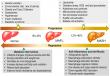 New Avenues for Treating Metabolic Dysfunction-Associated Fatty Liver Disease