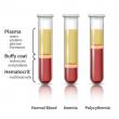 Blood Plasma Derivatives Market Projected To Witness Substantial Growth, 2025-2032:Biotest AG, Grifols,S.A., CSL Limited
