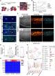 Delineating the Mechanisms Mediating Piezo-1- Induced Liver Regeneration