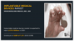 Implantable Medical Devices Market growing at a CAGR of 7.2% from 2021 to 2030 | CONMED Corporation, Globus Medical, Inc