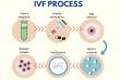 Unlocking Hope: The Booming Europe IVF Market 2025 and Assisted Reproductive Technology