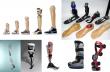 China Orthosis And Prosthetics Market Set to Witness Significant Growth by 2025-2032: Rehan International Co., Ltd