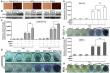 Innovative Study Highlights BMP9 and SHH as Key Drivers of Bone Repair