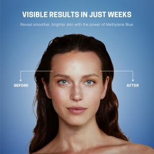 See the Science in Action: Proven Results with Methylene Blue Face Cream