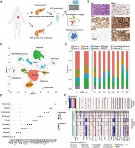 Identification of main cell populations in pancreatic ductal adenocarcinoma (PDAC).