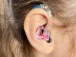 Hearing Aids Market Is Booming Worldwide 2025-2032: Sonic, Zounds Hearing, Audicus, GN Hearing, WS Audiology A/S, Oticon