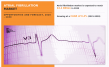 The Growing Atrial Fibrillation Market: Trends, Drivers, and Future Outlook