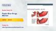 Peptic Ulcer Drugs Market to Reach USD 54.8 Billion by 2032 – Persistence Market Research
