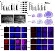 New genetic insights into hypospadias: MAFB and CEBPA’s role in urothelial growth