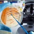 Microbiology Testing Market Analysis, Trends, Opportunities, and Forecast 2025-2034