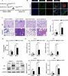 Inhibiting Sphingosine-1-Phosphate Receptor 3 (S1PR3) Mitigates Pulmonary Fibrosis