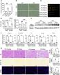Sexual Dimorphism in Cystinuria- The Mitochondria Link