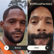 Farmer J’s Journey: TikTok Star Carl Brown Battles Medical Crisis—Leishmaniasis Contracted in Belize