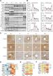 YTHDF1 Identified As a Potential Therapeutic Target for Autoimmune Hepatitis